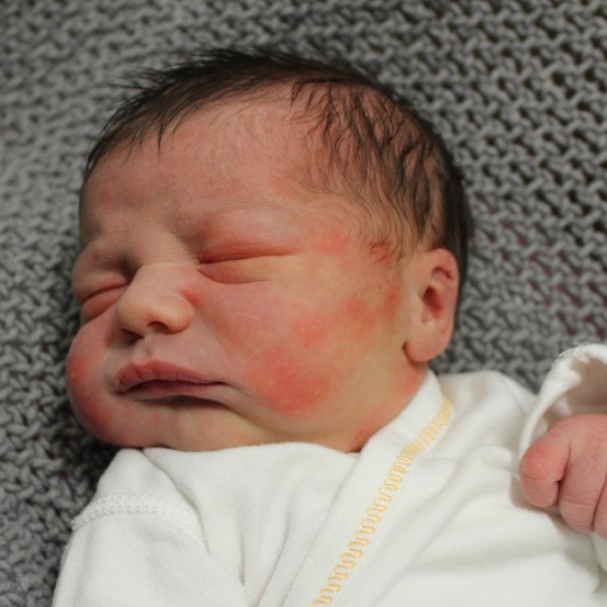 Huxley Thomas - CCM Health Special Deliveries